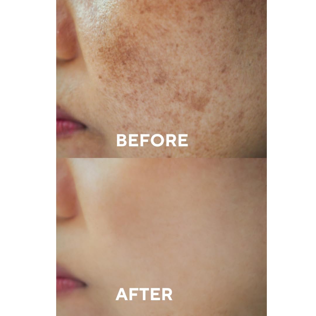 The Ceel Dark Spot Correcting Serum with Glutathione & Niacinamide – Brightening Facial Serum for Uneven Skin Tone, Hyperpigmentation & Dark Spots – Lightweight Face Serum – 30ml - 1.0 fl.oz