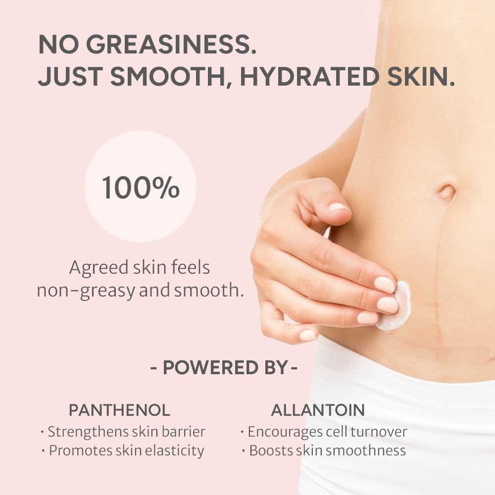 Noelo Hills Advanced Stretch Mark Cream for Pregnancy, Weight Gain, Growth Spurts - Pregnancy-Safe - Korean Skincare - Clinically Proven - Ultra Clean Ingredients - Fragrance Free - Vegan - 6.76 fl oz