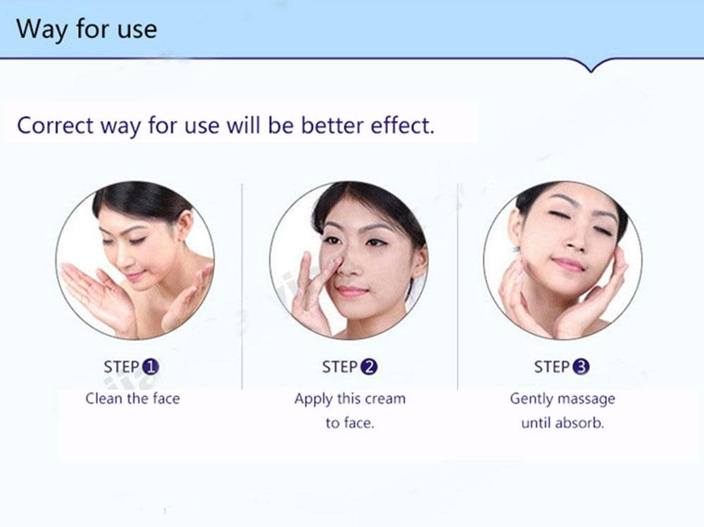 BIOAQUA Acne Scar Blemish Gel Spot Removal Oil Control Face Cream