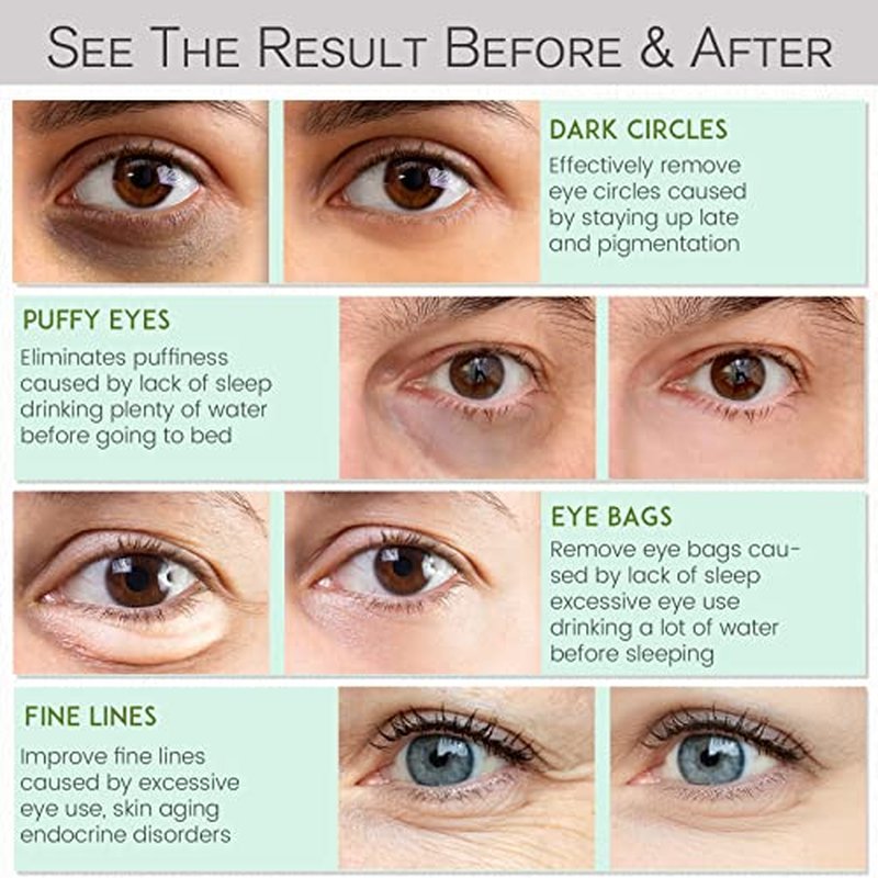 NAZANO Under Eye Patches - 30 Pairs - 24K Gold Eye Mask- Puffy Eyes & Dark Circles Treatments,Reduce Under Eye Bags and Smooth Wrinkles,Eye Skin Care Pads With Collagen