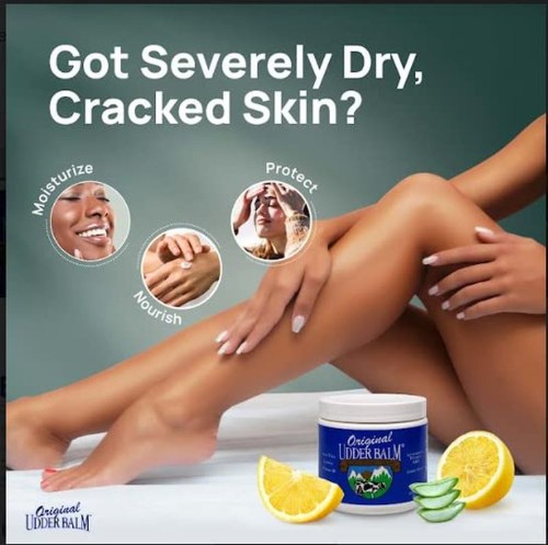 Original Udder Balm (NOT Cream or Lotion Body Moisturizing and Soothing for Dry, Cracked, Flaky, Rough Skin, 16 oz Jar, Lemon Scent