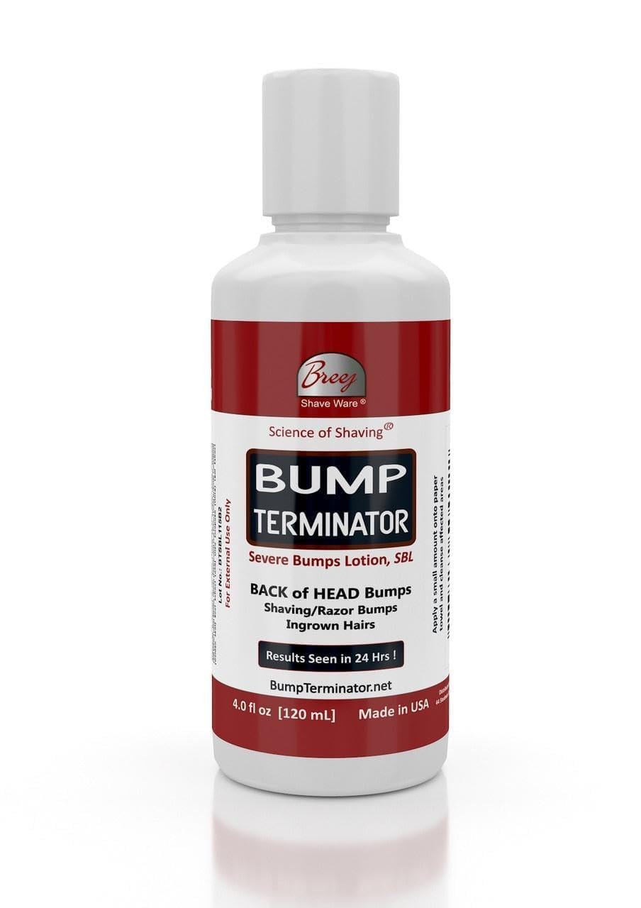 BUMP TERMINATOR Severe Bumps Treatment | Razor Bumps And Ingrown Hair Treatment | Bikini Bumps | Back of Head Bumps And Ingrown Hair Treatment, 4 oz (Pack of 1)