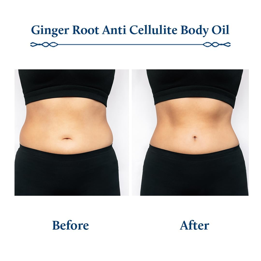 Blue Nectar Ginger Oil Anti Cellulite Body Massage Oil for Skin Tightening, Toning| Authentic Ginger Root Massage Oil with Plant Based Vitamin B & C for Women and Men (11 Herbs, 6.76 Fl Oz)