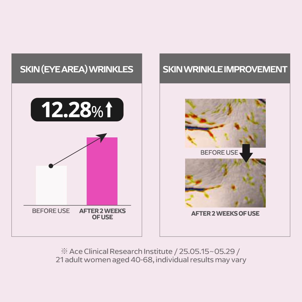 EUNYUL Ring Collagen 20% Face Serum (1.18 fl.oz / 35ml) – Korean Collagen Serum with 200,000ppm Collagen, Peptides & Niacinamide, Hydrating & Firming Skin Care