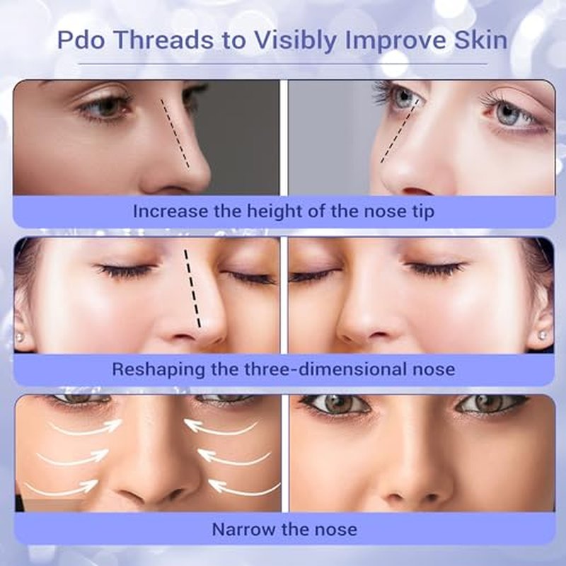 SOZOOM PDO Thread Nose Lift, PDO Cog Threads Improve the Shape of the Nasal Columella and Alar L-Blunt Type Cog Thread Lift (16pcs-19G-38mm (l))