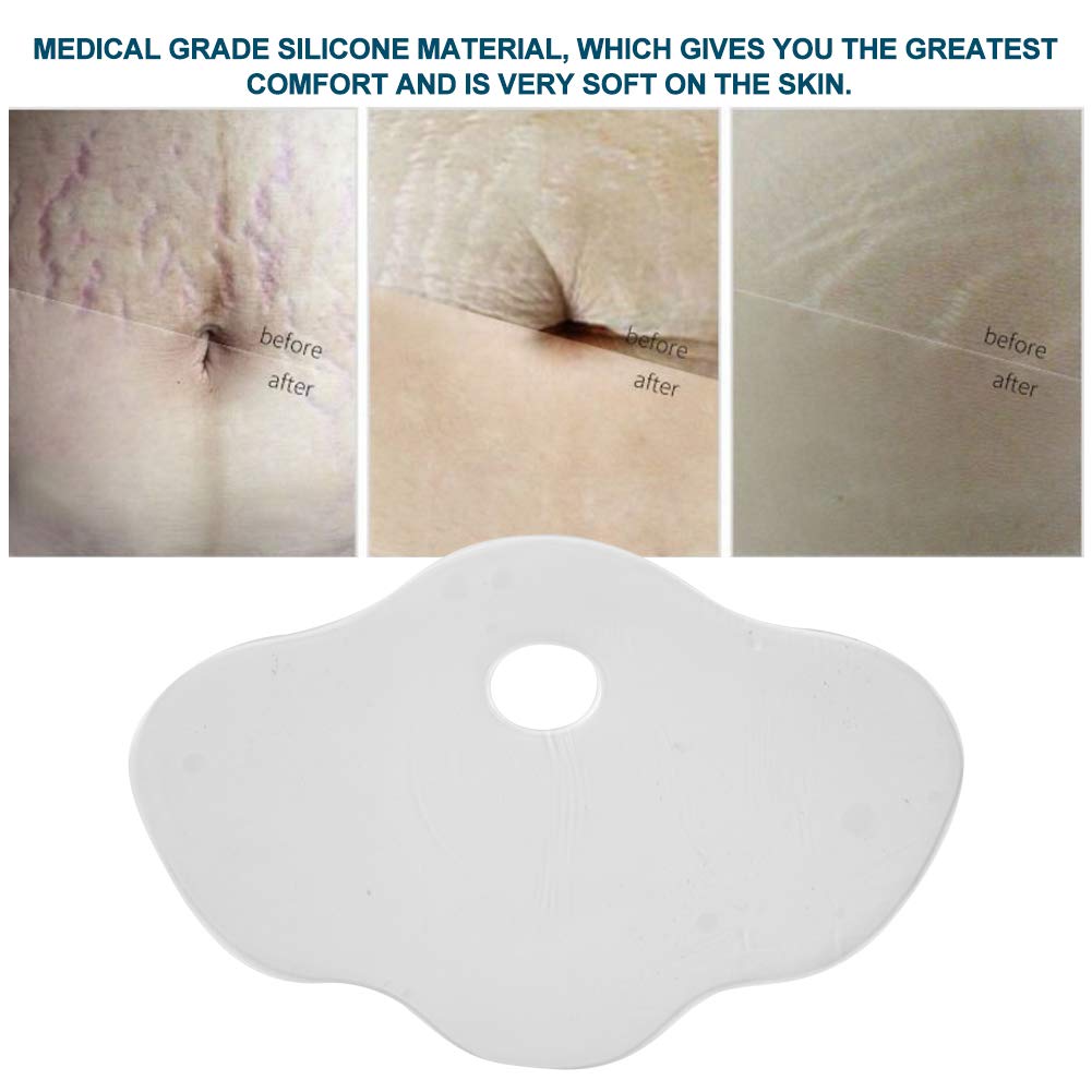 Silicone Stretch Mark Patch for Scar Removal, Lift Tighten Lightweight Reusable Washable Transparent Belly Skin Care Supplies