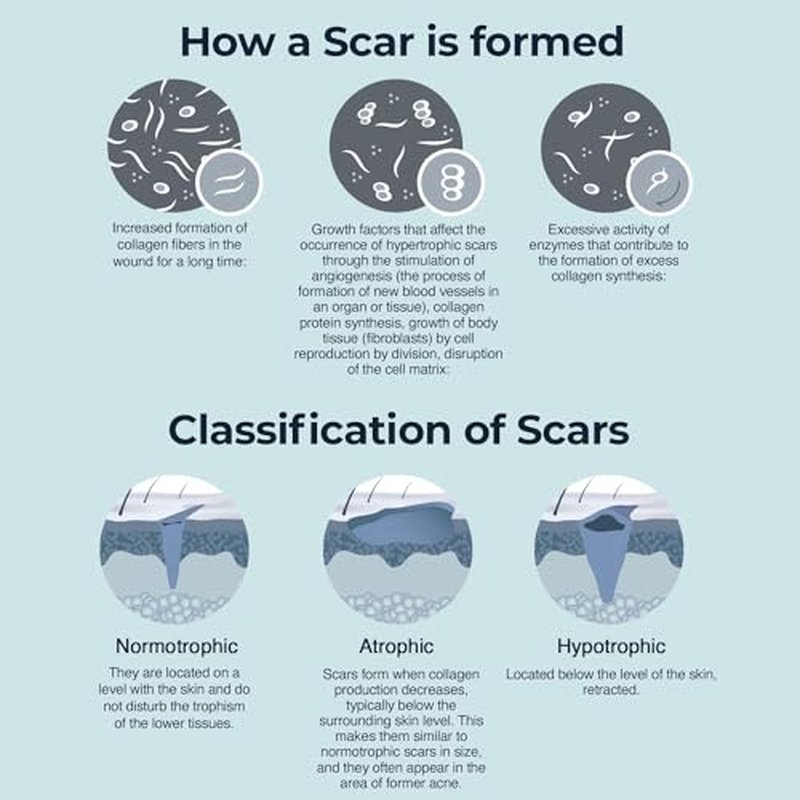 Silicone Scar Cream for Surgical and Bug Bite Scar Remover 0.73 Fl Oz - Scar Cream for New & Old Scars, C-Section and Burns - All Natural Acne Scar Cream for Face with Vitamin E, Retinol and Allantoin