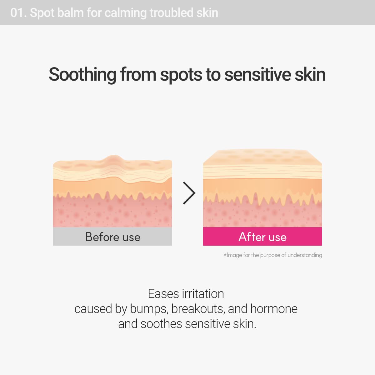 ROVECTIN Cica Care Face Balm - Immediate Redness Relief Face Moisturizer for Acne Prone, Sensitive Skin | Spots, Scar Reducing with Calamine and Madecassoside | Vegan, Korean Skincare(1.4 fl oz)