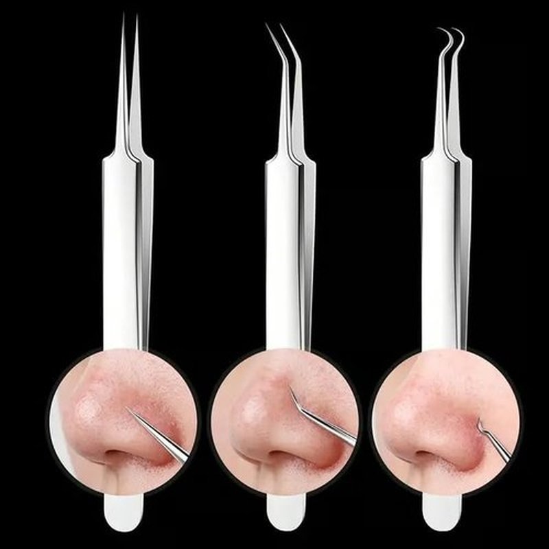 Usiveinborn Blackhead Remover, Usiveinborn Tweezers, Usiveinborn Professional Facial Blackhead Remover Tweezers, Pimple Popper Tool Kit, Ingrown Hair Tweezers (1Set-3pcs)