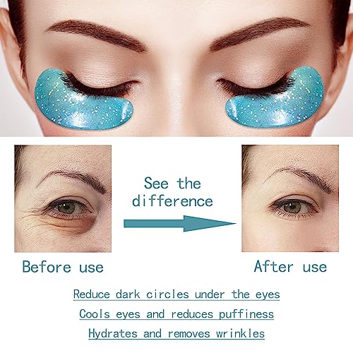 Under Eye Patches for Puffy eyes, 10Pairs eye gel pads for Dark Circles and Puffiness, hydrating Eye Mask for Wrinkles Anti Aging Eye Bags Moisturizing, Natural vitamin C undereye Care Gifts for Women