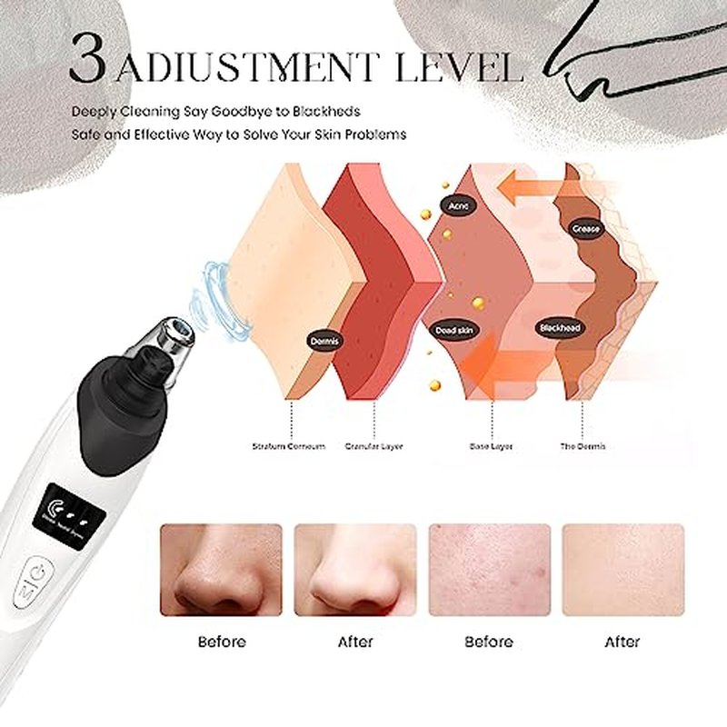 2024 Blackhead Remover Pore Vacuum,Facial Pore Cleaner-5 Suction Power,5 Probes,USB Rechargeable Blackhead Vacuum Kit Electric Acne Extractor Tool for Adult (Black)