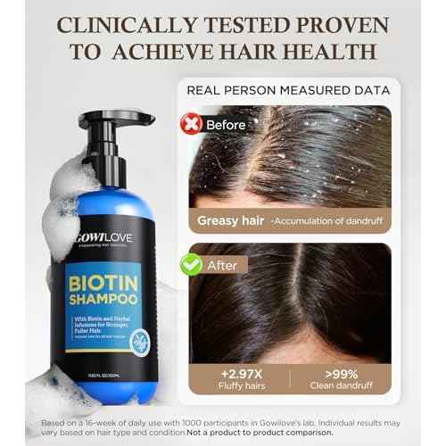 99% Pure Biotin Shampoo for 3X Thicker, Fuller Hair Growth, 80% Less Hair Loss w/Thuja Extract, Batana & Noni Fruit Oil Hair Care for Deep Nourishing,Rosemary Dandruff Treatment for Men Women,11.83oz