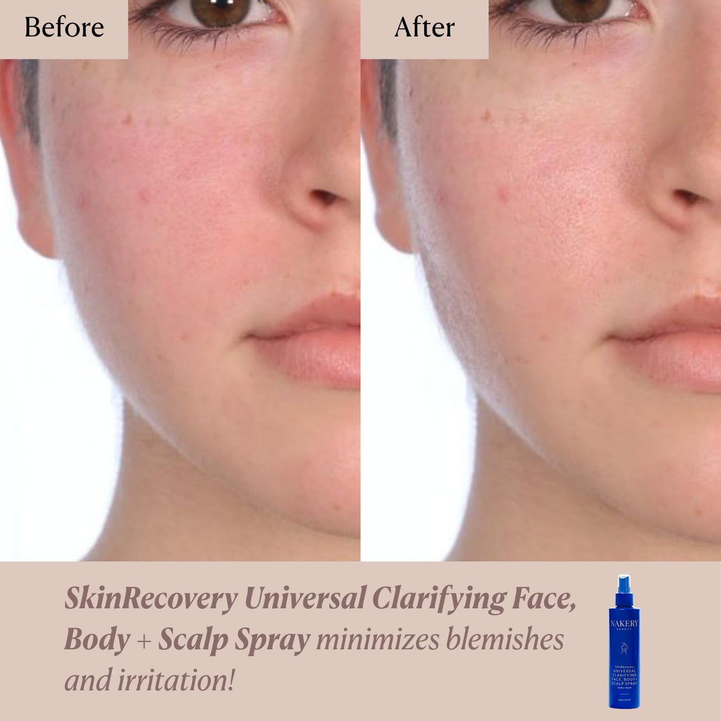 Nakery Beauty SkinRecovery Universal Clarifying Face Body And Scalp Spray With Hypochlorous Acid, Soothing pH Balanced Mist For Sensitive Skin, Helps Reduce The Look Of Redness, Made In USA