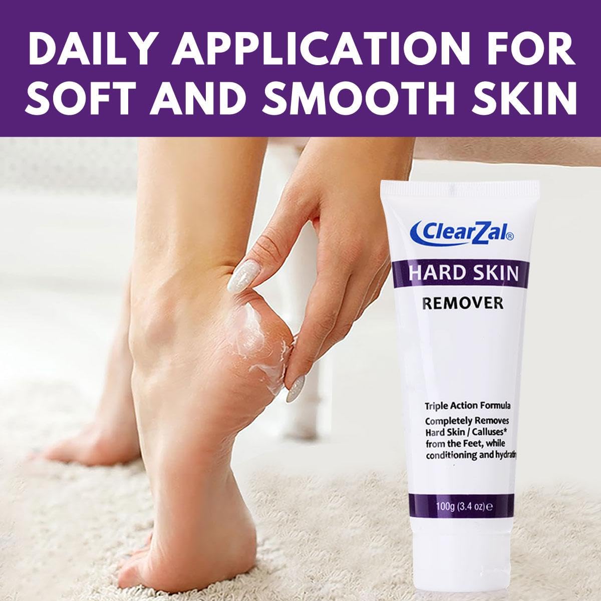 Clearzal Foot Cream For Hard Skin, Helps Calluses and Corn Removal While Leaving Soft Smooth Skin, Hydrating and Conditioning Triple Action Formula With Aloe Vera, 3.4 Ounce Tube