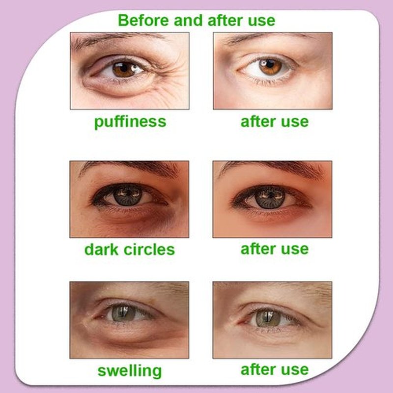 Hot and Cold Eye Pads，Reusable Eye Patches - Soothing, Revitalizing, Puffiness, Refresh, Relieves Stress, Relax, Relieves Puffiness and Tension(2 Watermelons + 2 strawberrys)