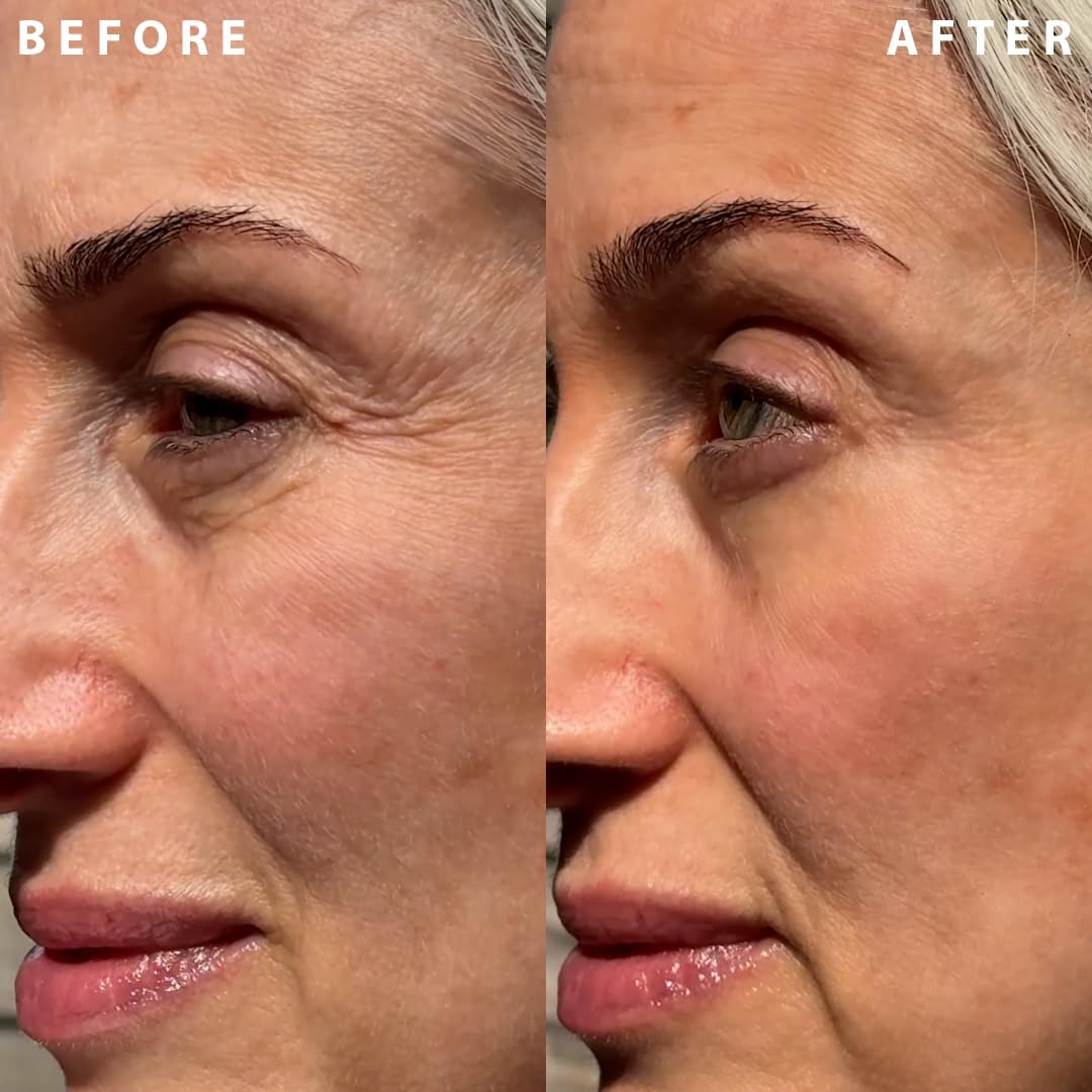 IL MAKIAGE - Power Redo Wrinkle Fix - Advanced Anti-Aging Blur & Smooth Wrinkle Filler - Coffee Seed + Vitamin C + Rosehip Oil - 20 ML