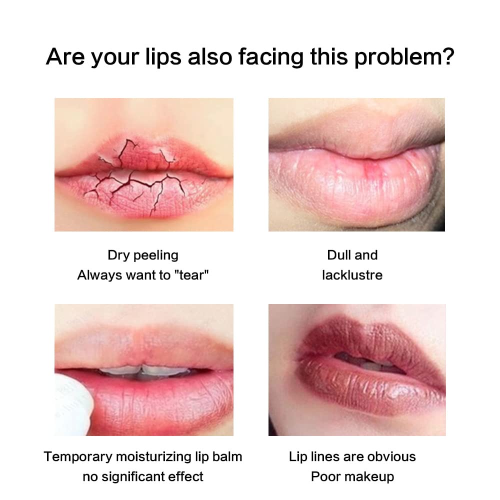 Lip Collagen with Peptide & Stem Cell Complex, Lip Balm for Dry Lips, a Lip Moisturizer for Lip Care and Lip Treatment