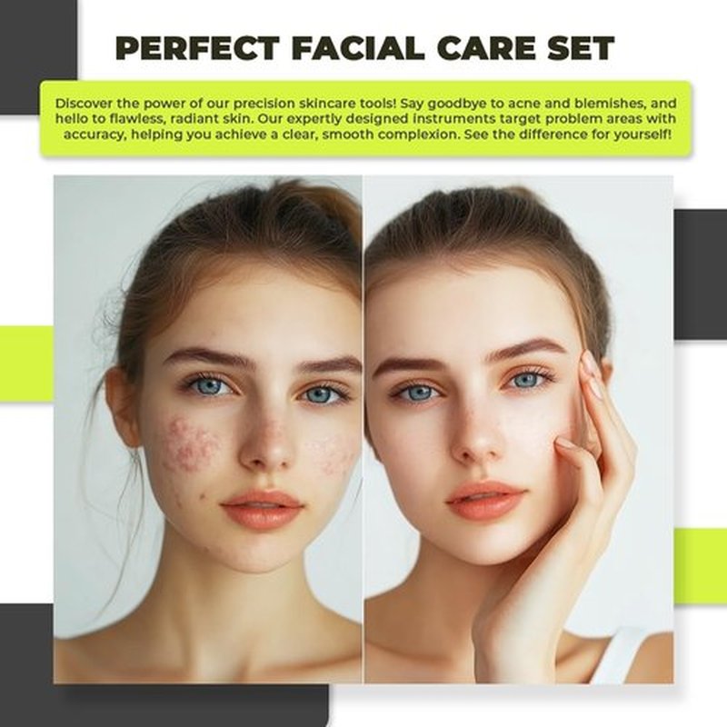 [6 Pcs] 2024 Latest Pimple Popper Tool Kit | Stainless Steel Blackhead Remover with Leather Case & Mirror for Acne, Blackheads, Whiteheads, Face & Nose