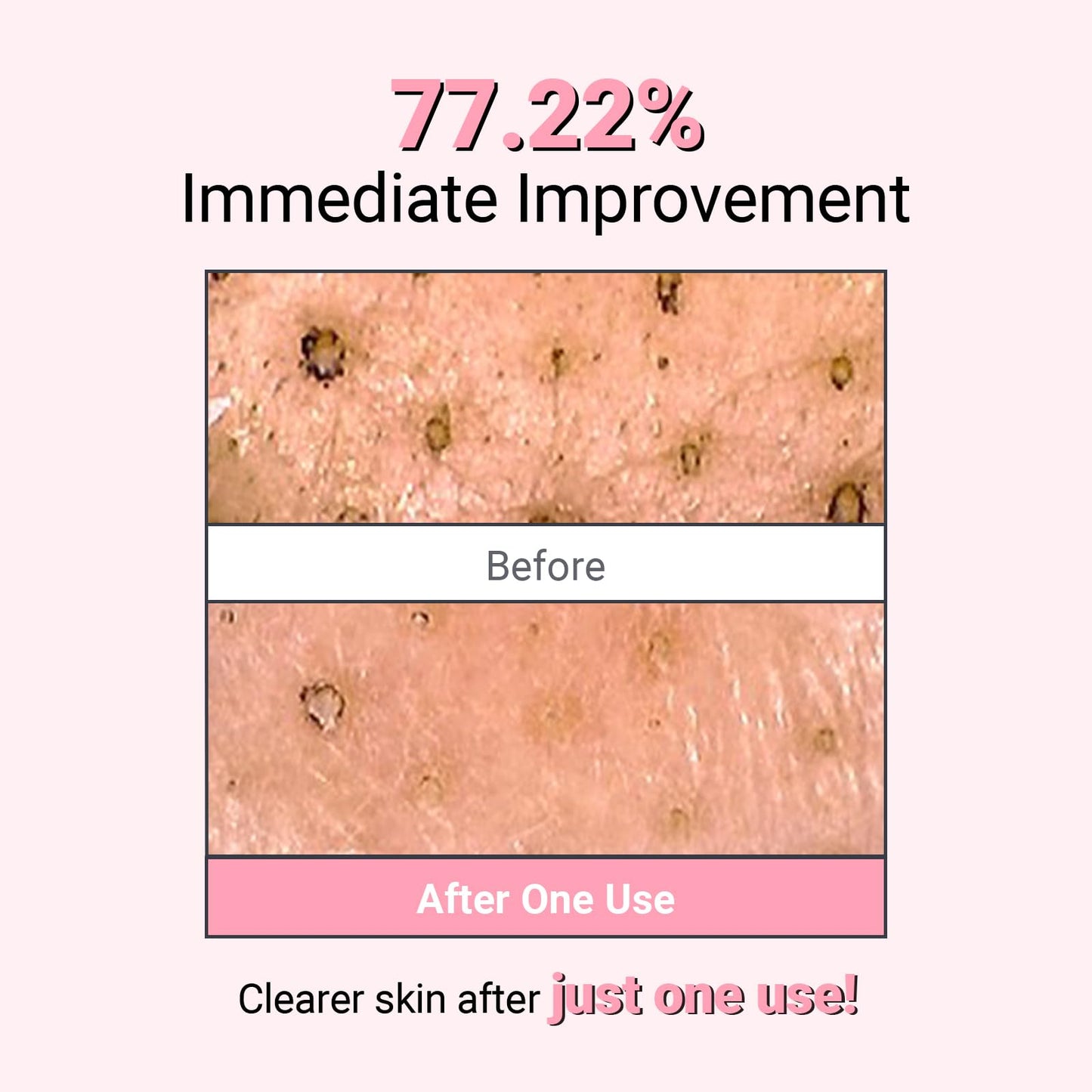 NEAF NEAF Kaolin Purifying Wash Off Pack, Pore Cleansing Mask for Dry Sensitive Skin, Softening and Hydrating, Korean Skincare (3.88oz / 110g)