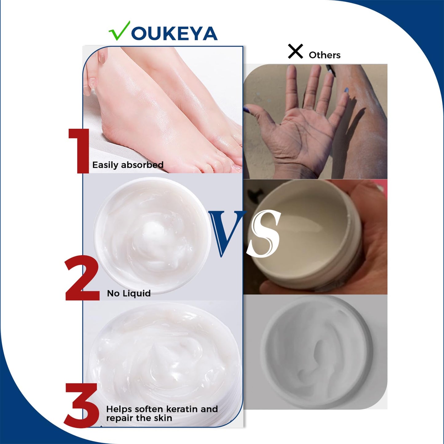 OUKEYA Urea Cream 40 Percent for Feet and Cracked Heels, 5.29 oz