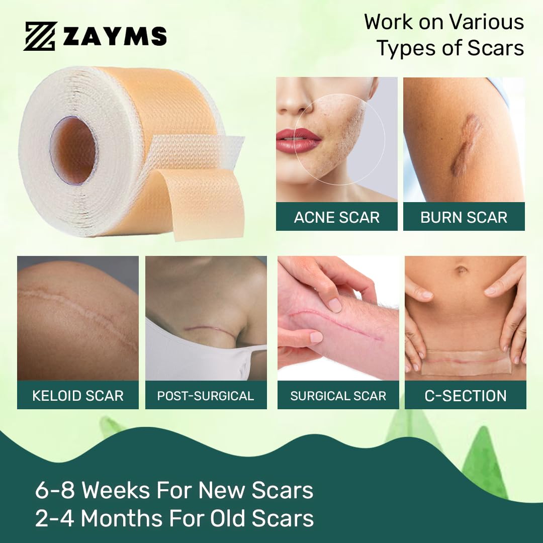 Silicone Scar Tape (1.6” x 120” Roll-3M), Silicone Scar Sheets for Scar Removal, Medical Grade Reusable Tape Strips for Surgical Scars, Keloid, C-Section, Burn, Acne, and Tummy Tuck