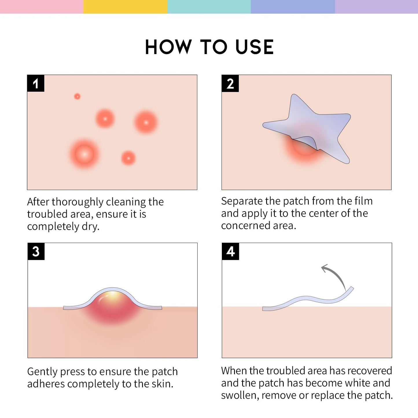 #OOTD Star Pimple Patches – Hydrocolloid Acne & Spot Patch for Face, Cute Pastel Colors, Niacinamide & Ceramide, K-Beauty Skincare – Stocking Stuffer for Teen Girls – 80 Count