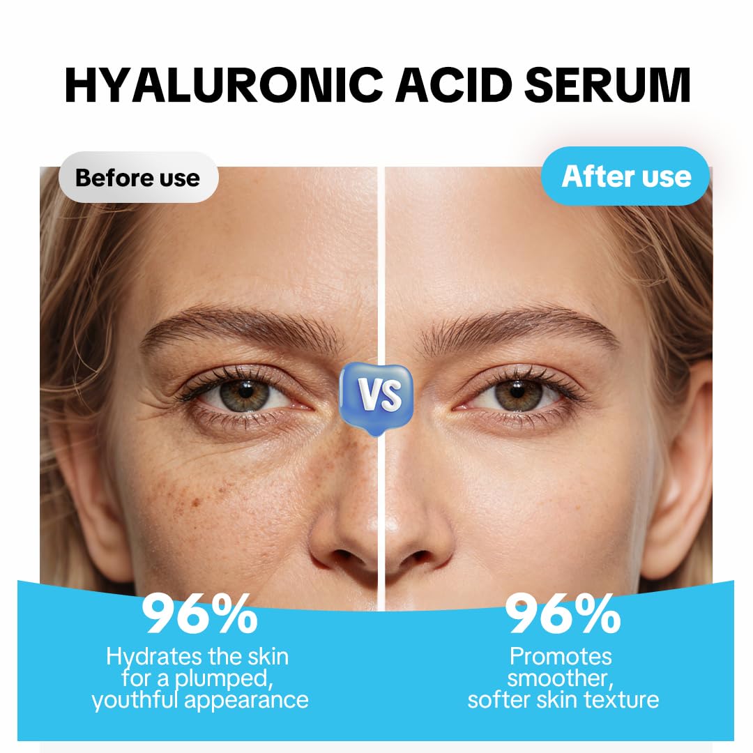HERBICOS Hyaluronic Acid Serum for Face - 1 Fl Oz with Vitamin C, E & Jojoba Oil - Hydrating Anti-Aging Facial Serum, Brightens & Plumps Skin, Fast Absorbing Non-Sticky Formula