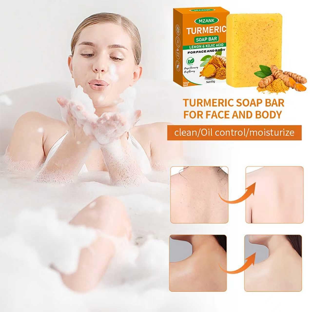 MZANK 2 Pack Kojic Acid Soap,Dark Spot Remover Turmeric Soap Bars Moisturizing with Collagen,Vitamin,Hyaluronic Acid,Retinol,Shea Butter,Tumeric Soaps for Face Body All Skin Types