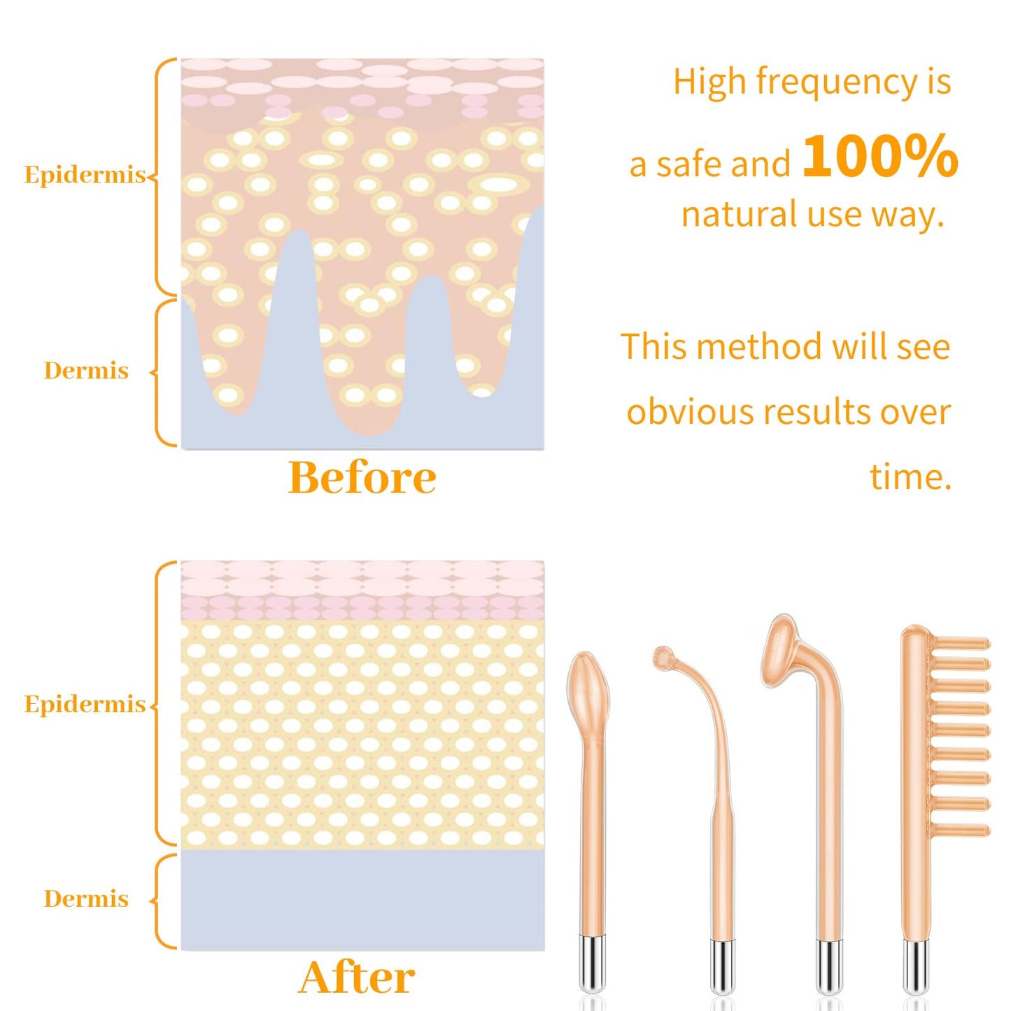MYSWEETY High F Rrequncy Portable Handheld Facial Skin Care Wand Machine