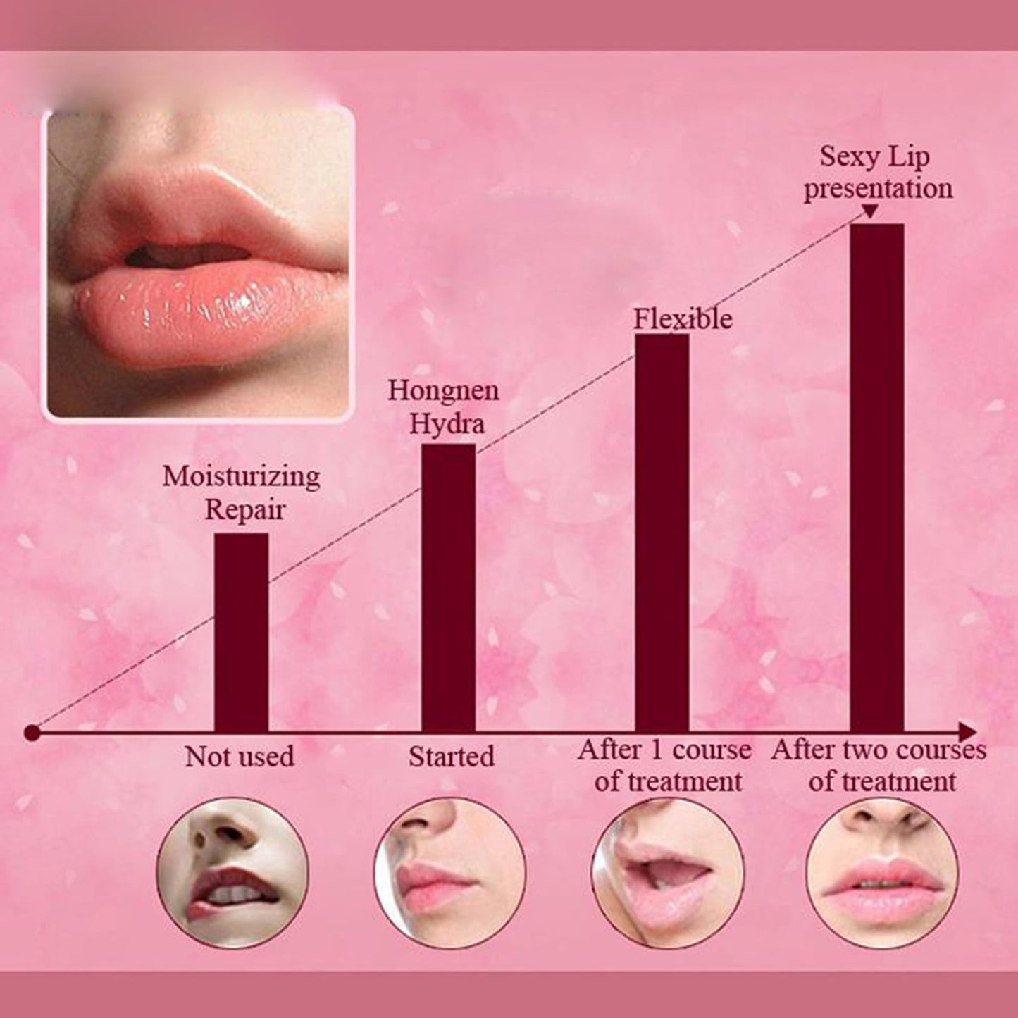 Felico 30PCS Lip Mask Patches,Collagen Crystal Pink Care Gel Pads for Moisturizing,Reduced Chapped,Smoothing,Fine Lines,Remove Dead Skin Moisture Essence Make Your Dry Lips Attractive Sexy Strawberry