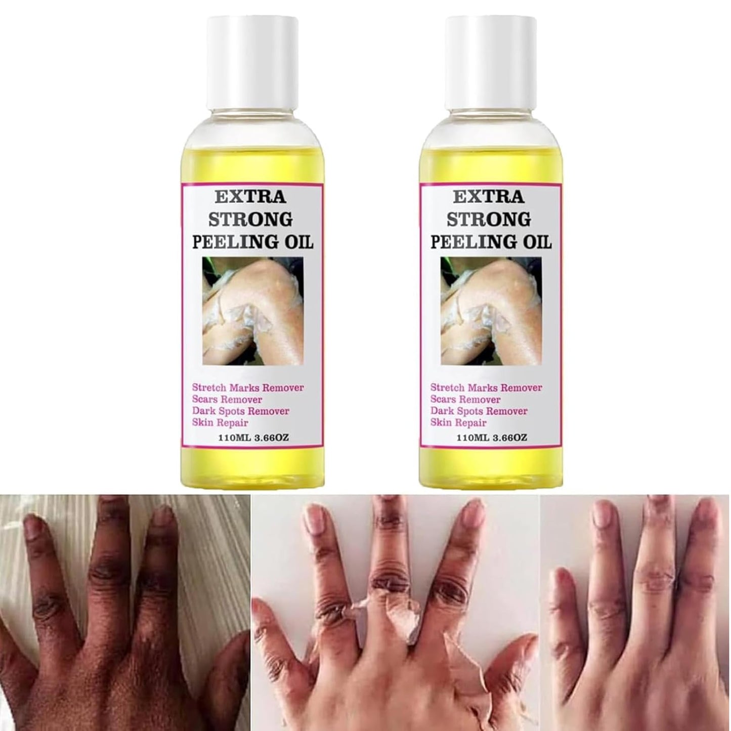 Yellow Peeling Oil for Dark Skin, Extra Strong Peeling Oil, Natural Formula Exfoliating Peels Solution for Face, Body, Hands and Foot Dead Skin Remover (220ML/7.76 OZ)
