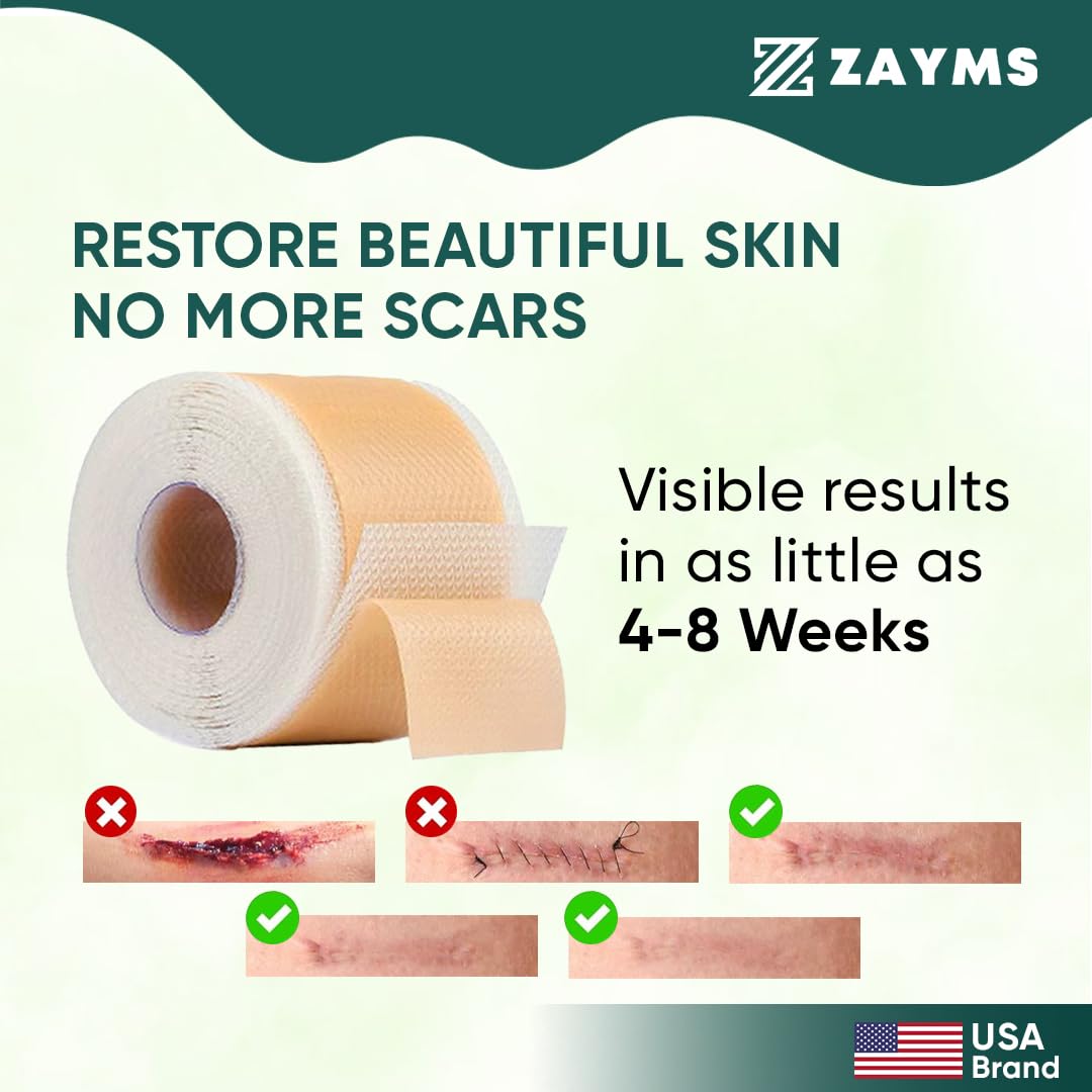 Silicone Scar Tape (1.6” x 120” Roll-3M), Silicone Scar Sheets for Scar Removal, Medical Grade Reusable Tape Strips for Surgical Scars, Keloid, C-Section, Burn, Acne, and Tummy Tuck