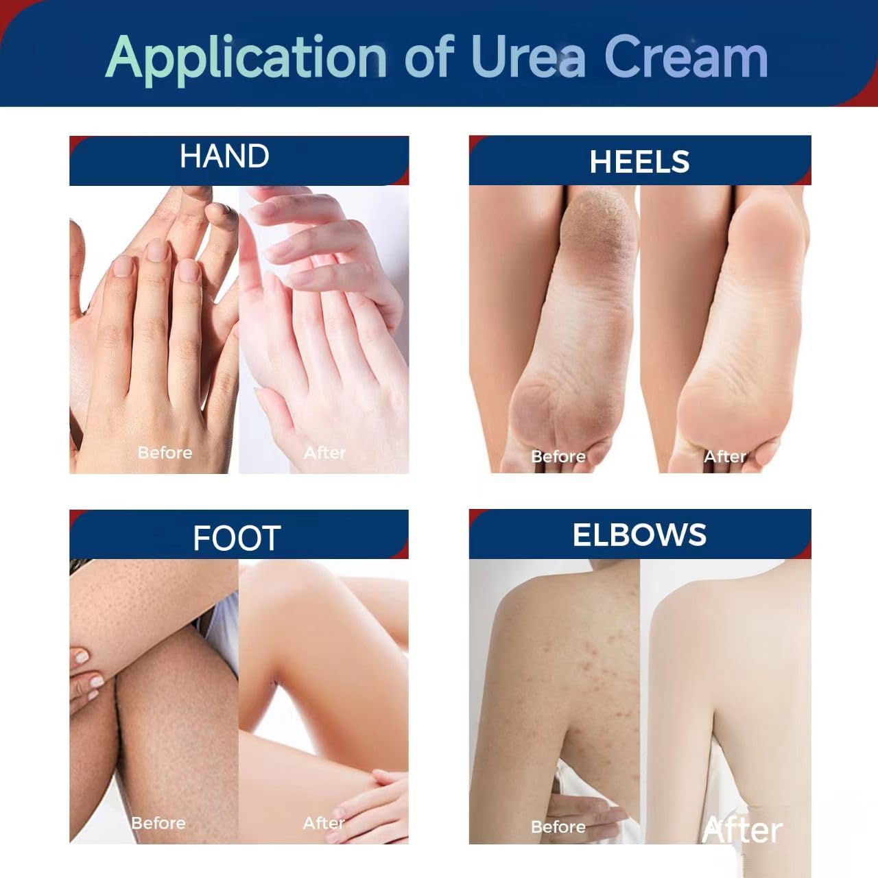 OUKEYA Urea Cream 42 Percent with 2% Salicylic Acid, 3 Oz Foot & Hand Cream for Dry Cracked Heels, Deep Moisturizing & Softening Keratin Feet Cream, Nourishing Skin Care Lotion for Rough, Dry Areas