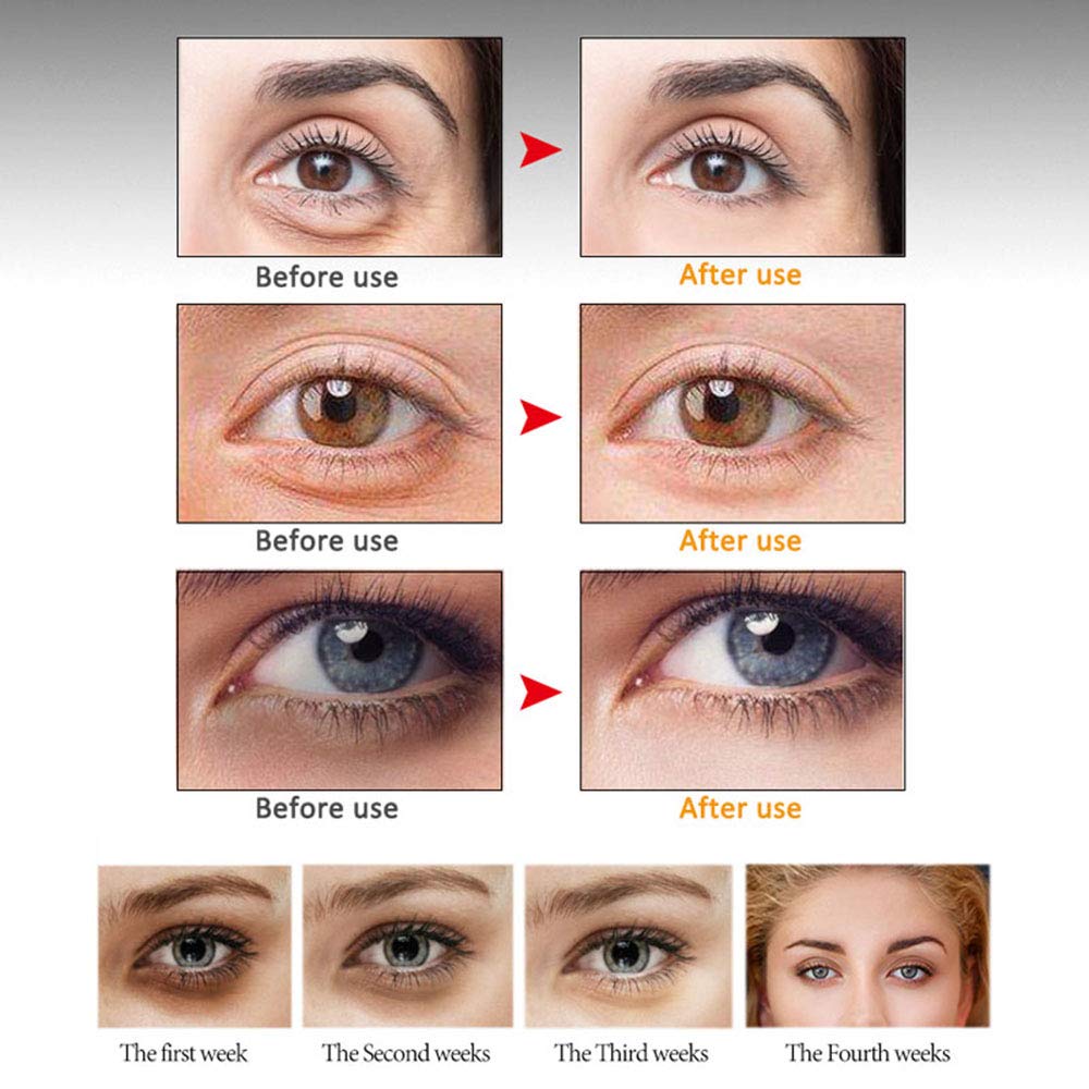 MIESCHER Eye Peptide Serum Massage Roller Nourishing Relieve Loose Eye Bags Dark Circles Skin Care Under Eye Cream for Fine Wrinkles and Puffiness Daily Skincare(Nourishing Grey)