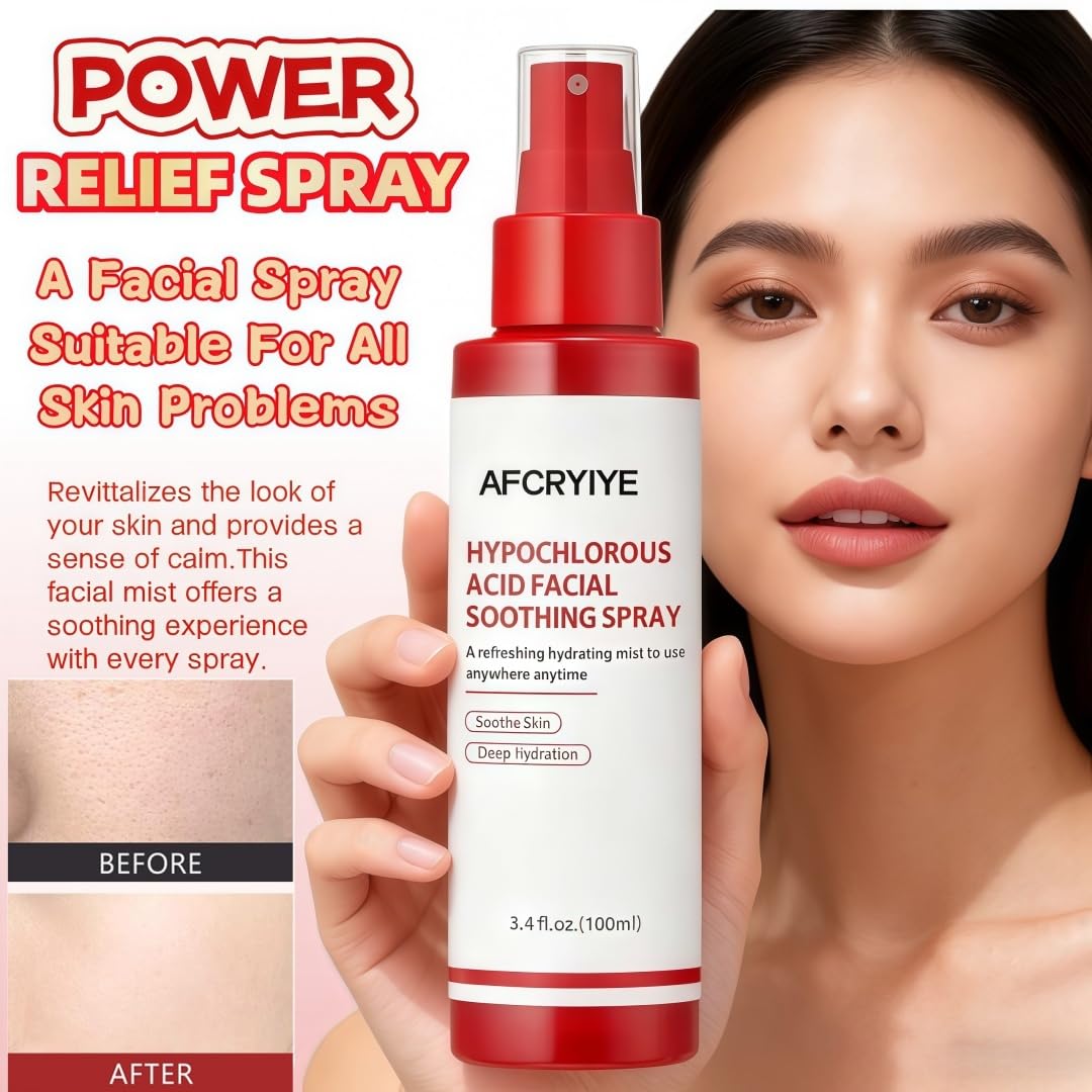 AFCRYIYE Hypochlorous Acid Facial Spray - Soothing Calming Mist for Sensitive, Delicate & Acne-Prone Skin | Daily Use, Post-Sun Care, Korean Skincare Formula | 3.4 Fl Oz