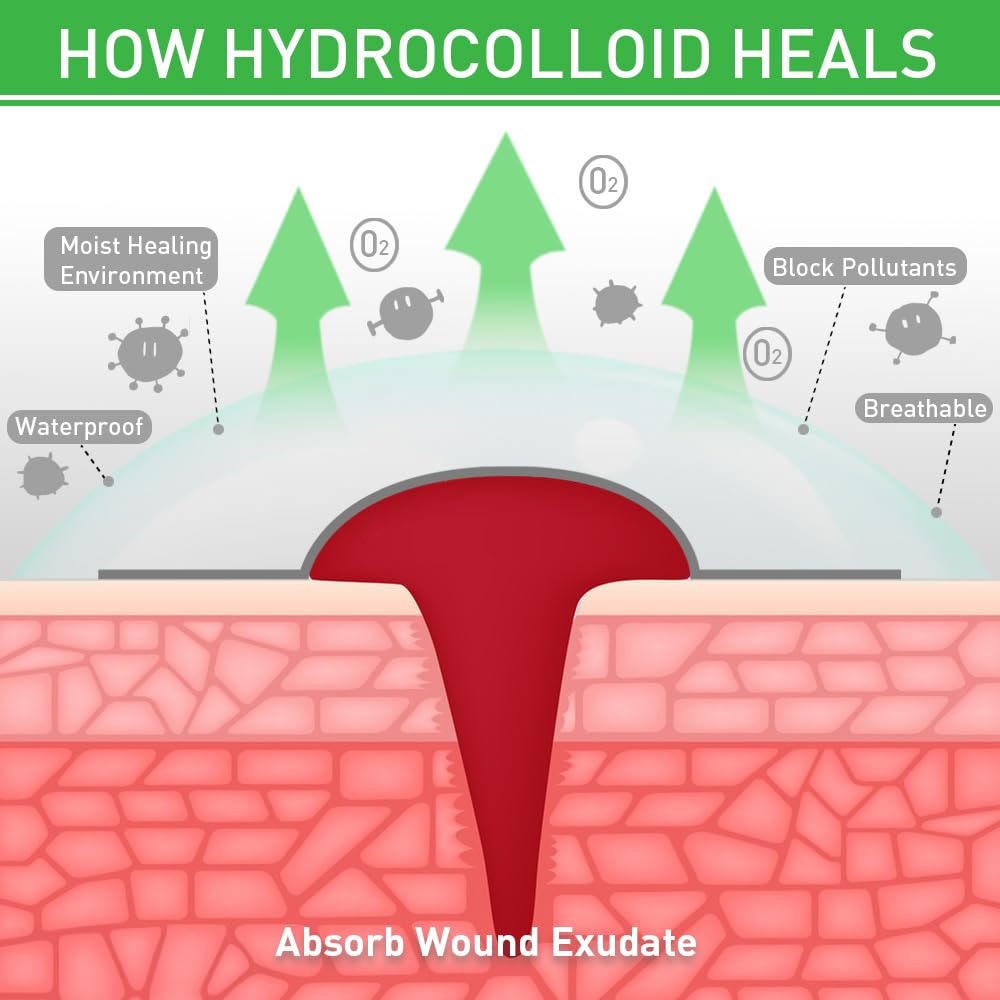 Hydrocolloid Roll for Wound Care 2in*12ft, Large Hydrocolloid Bandages Patch with Self-Adhesive Waterproof Ultra Absorbent Flexible DIY Size & Shape First Aid Kit Essential