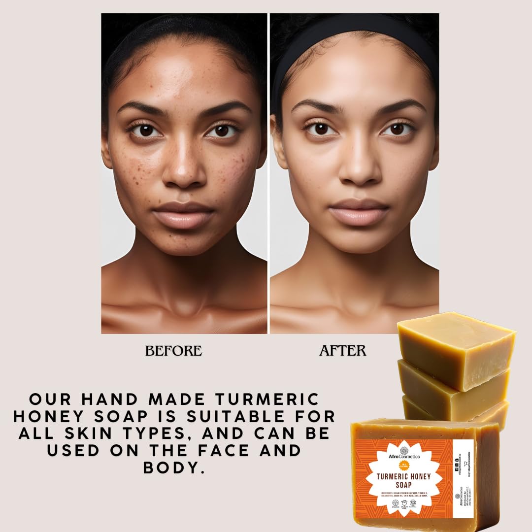 AFROCOSMETICS Turmeric Honey Bar Soap For Face and Body Cleanser Soap 4 oz Bar