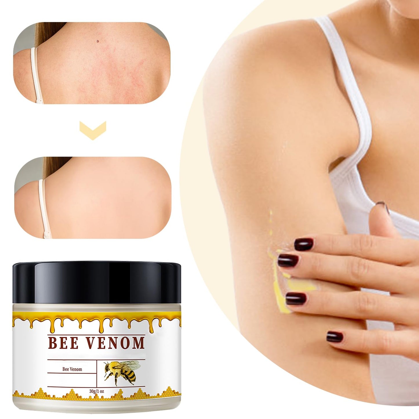 3 PCS Bee Venom Skin Treatment Cream, New Bee Venom Comprehensive Cream, Face lifting and firming, Natural Serum Suitable Gentle for All Skin Types