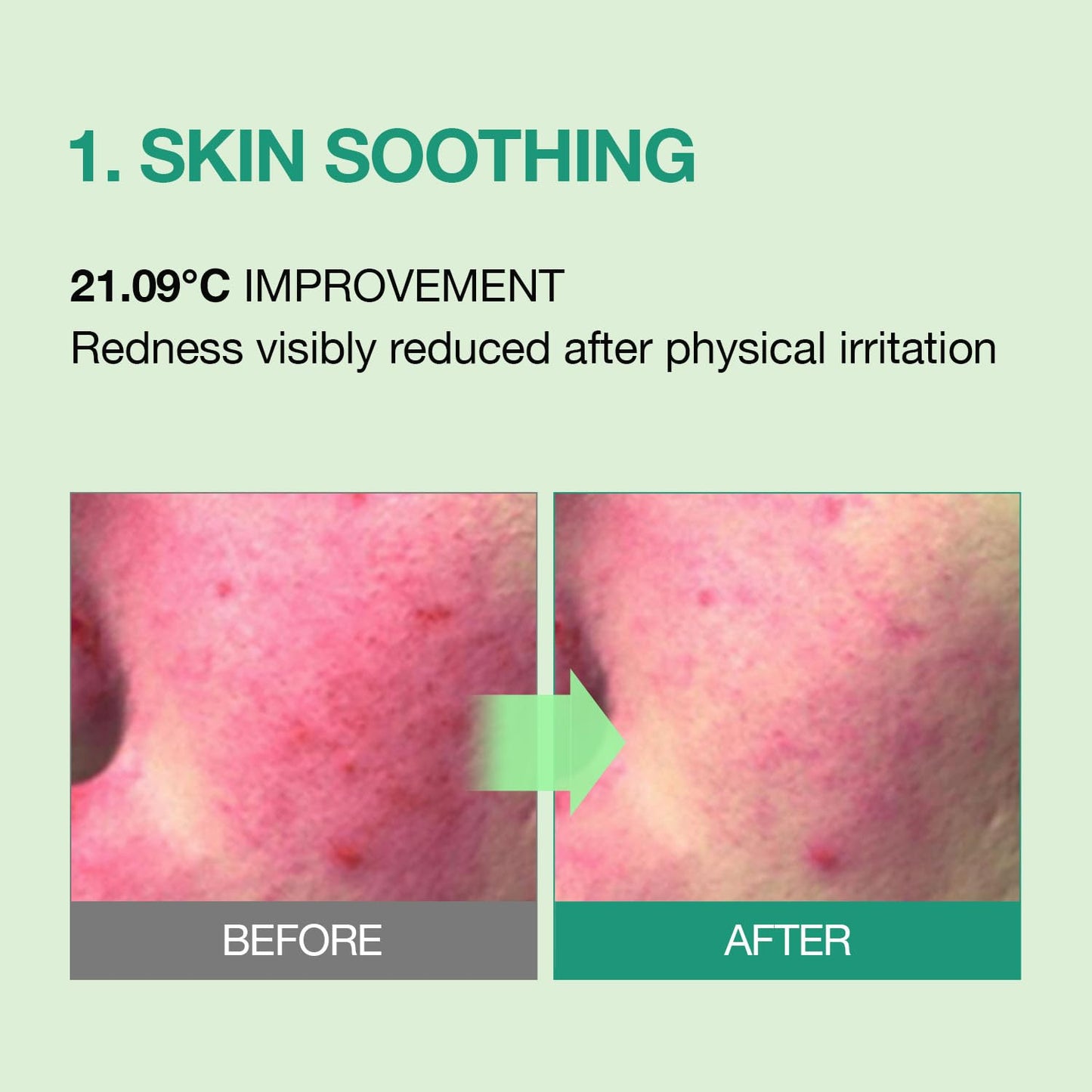 ESSENHERB Tea Tree Calming Cream for Acne-Prone & Sensitive Skin | Soothing & Blemish Care with Cica, Madecassoside & Panthenol | Korean Skincare 2.70 fl oz