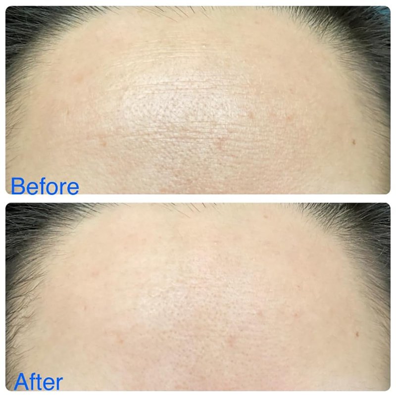 UOG (United One Collagen Complex - Anti-Wrinkle Essence for Face & Neck. Ultimate Firming & Lifting Moisturizer. Day-to-Night Hydrating & Smoothing for All Skin Types. 30ml/1.05oz