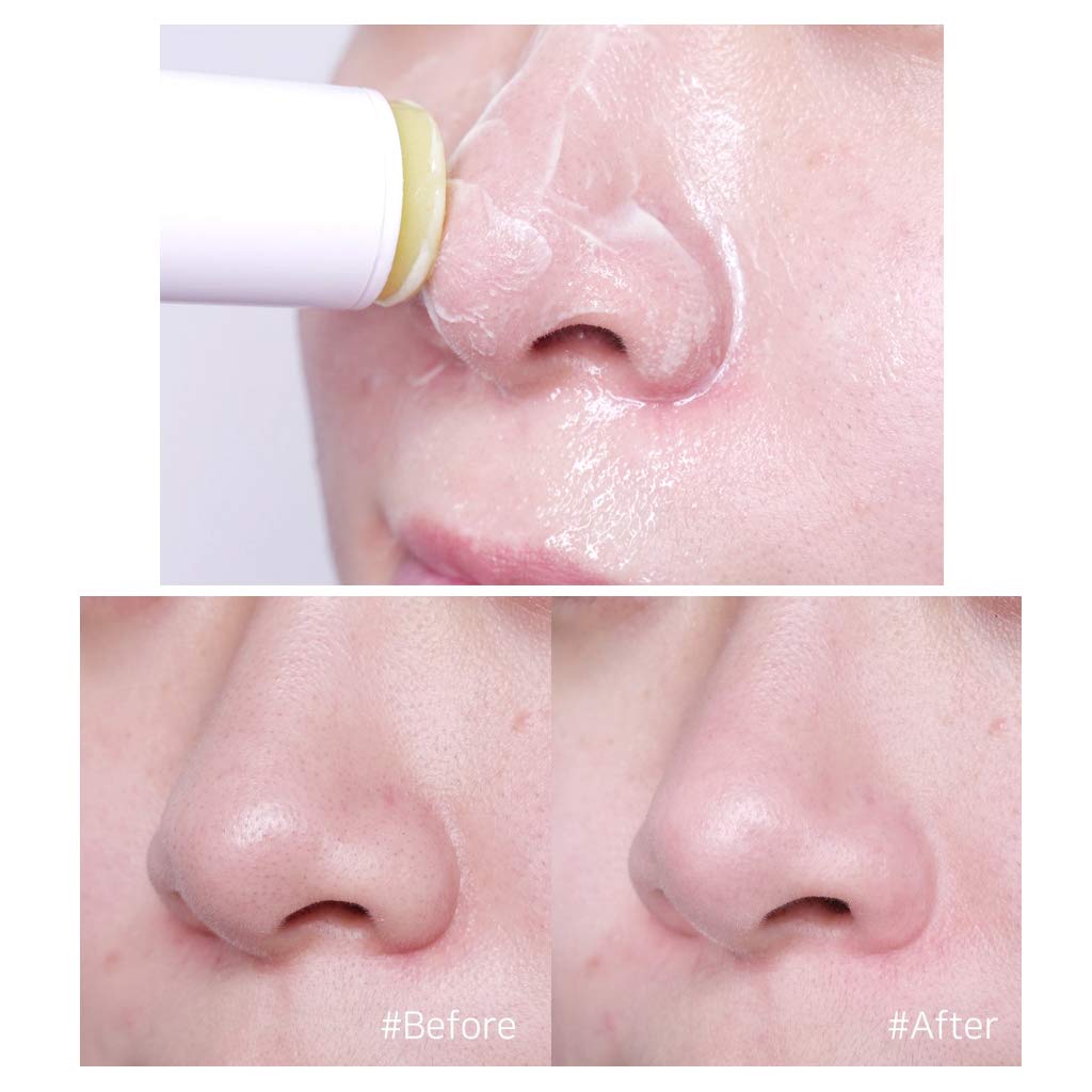 THESAEM Calamansi Pore Stick Cleanser 15g - Skin Clearing Pore Deep Cleansing Stick. Removes Blackheads and Sebum, Exfoliating Dead Skin Cells