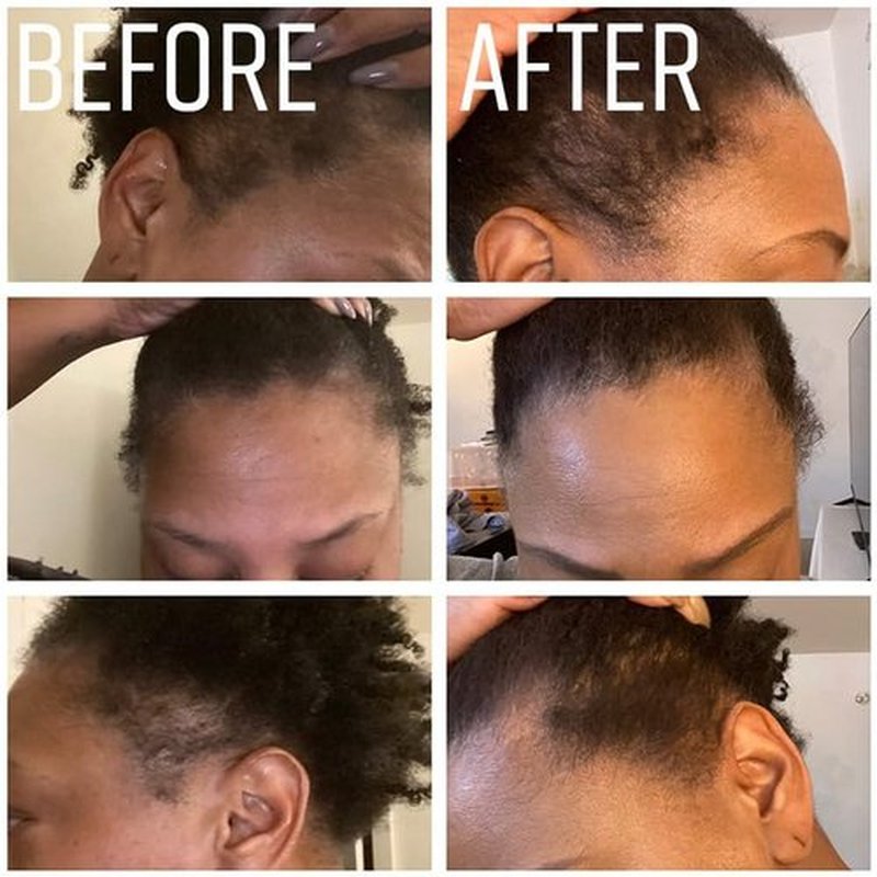 4oz Organic Cold Pressed Jamaican Black Castor Oil for Hair Growth and Damaged, Dry Scalp - Unscented, Hexane-Free