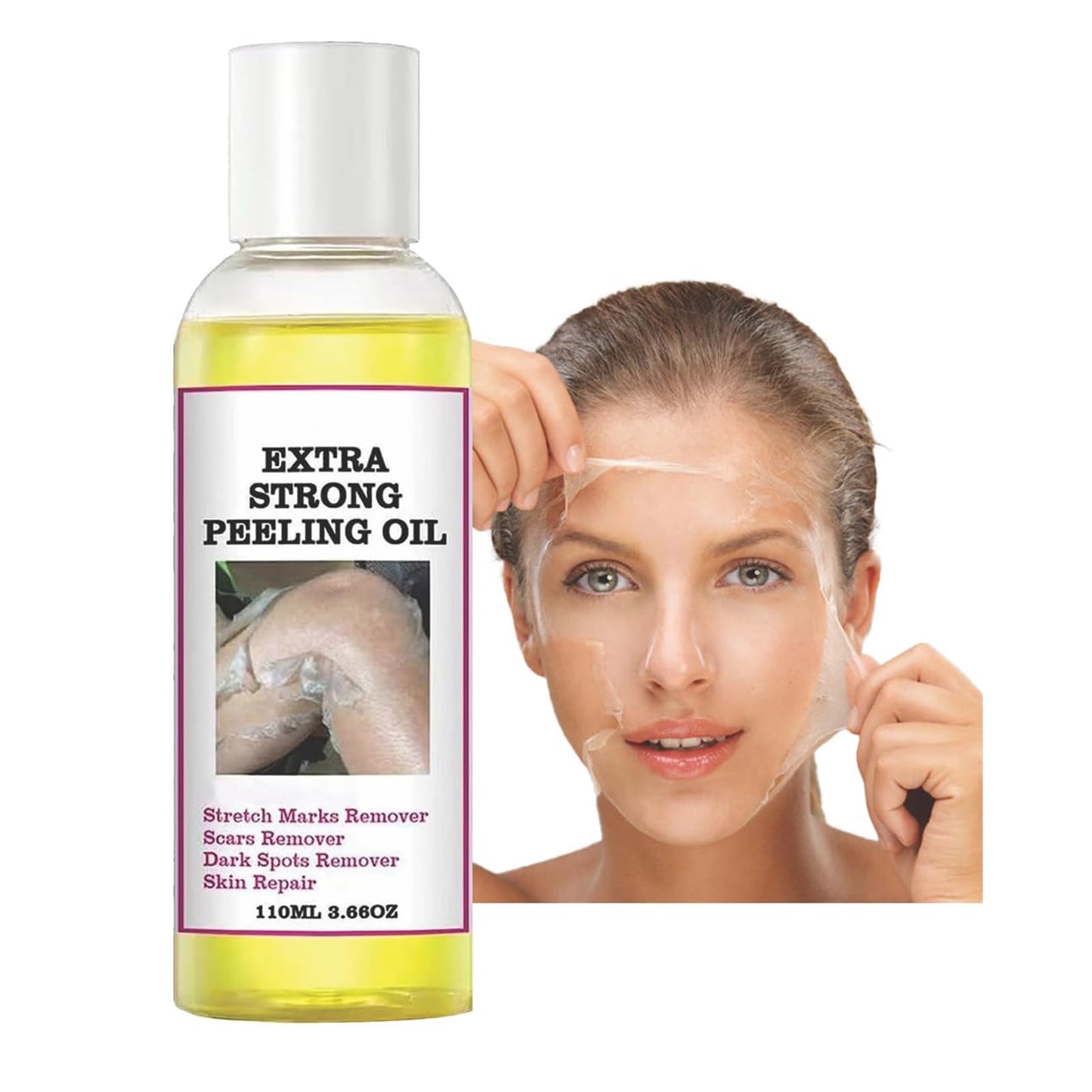Generic Extra Strong Peeling Oil, Peeling Oil for Dark Skin, Yellow Peeling Oil, Exfoliating Peeling Solution for Hand Feet, Chemical Peel for Face, 110ML / 3.88 OZ (1 PCS)