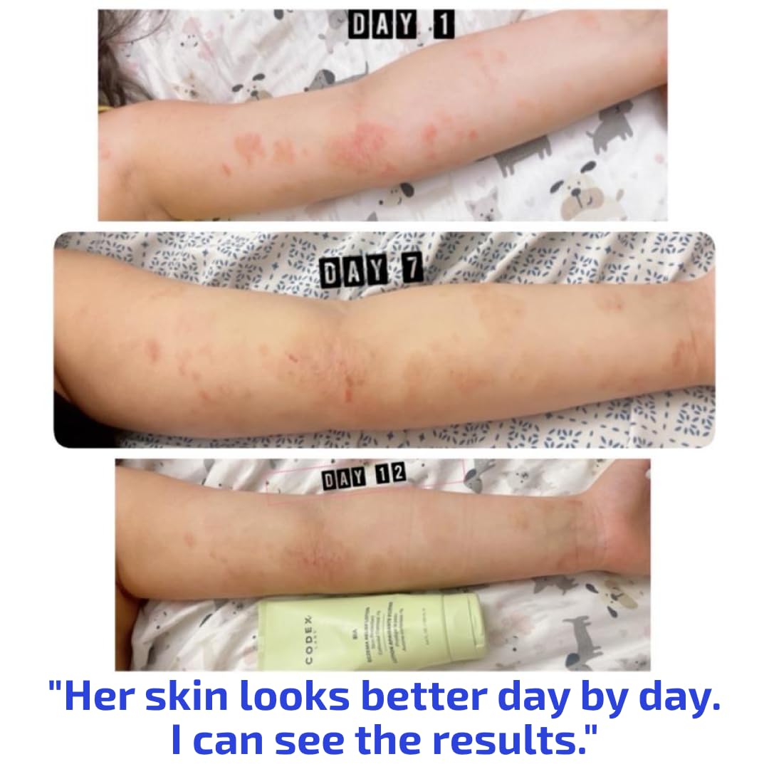 Codex Labs Eczema Relief Lotion with Colloidal Oatmeal, 3.4 oz