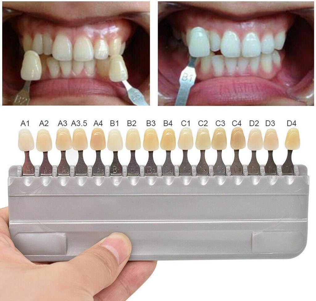 3D Teeth Whitening Shade Guide - 16 Color Tooth Bleaching Chart | Dental Material for Oral Care