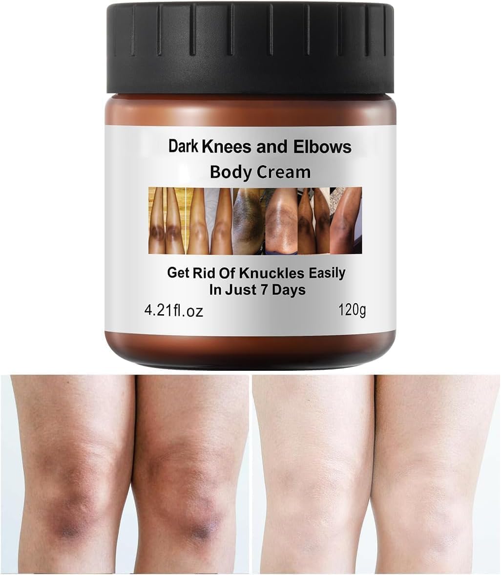 Dark Elbow and Knees Remover, Skin Brightening Cream for Dark Inner Thigh