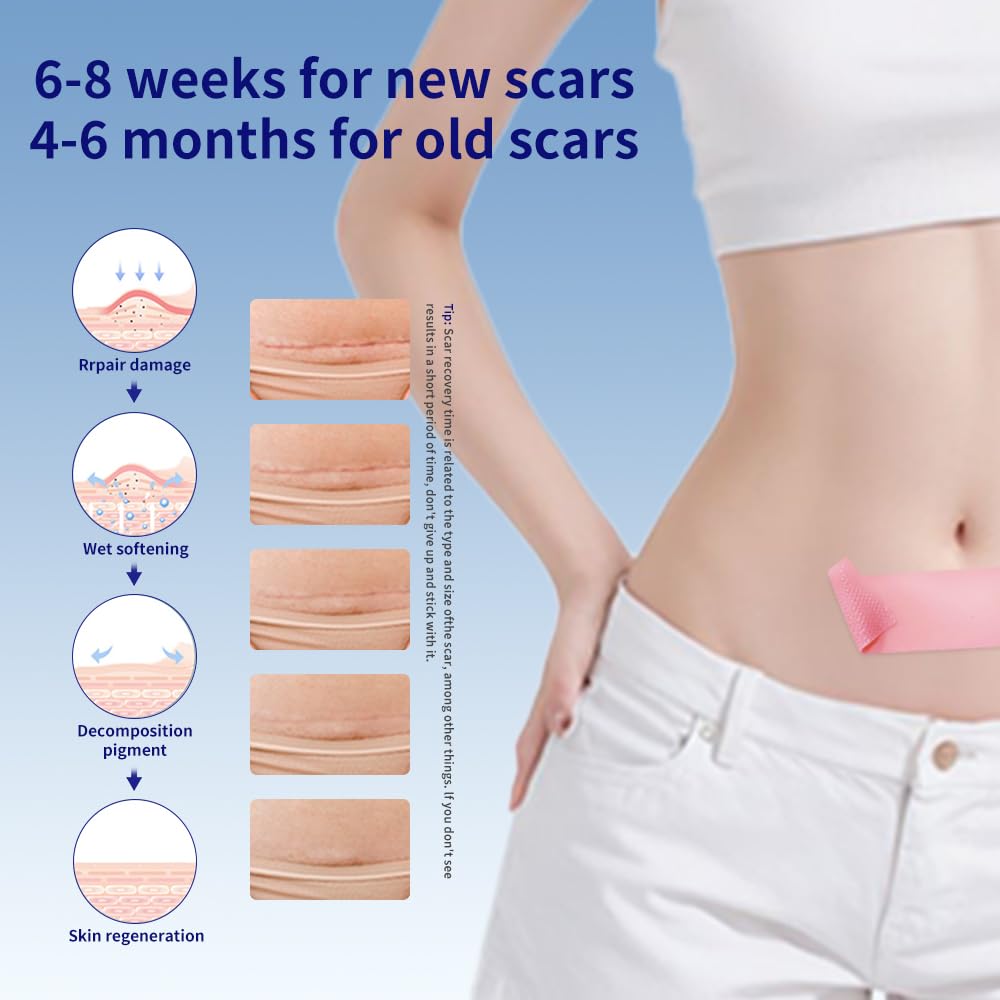 Silicone Scar Sheets 1.6"x39.4" Roll-1M Scars Removal Treatment Medical Grade Silicone Scar Tape for Skin Resuable Strip for Tummy Tuck,Incision,Keloid,C-Section,Burn,Acne Scars(pink)