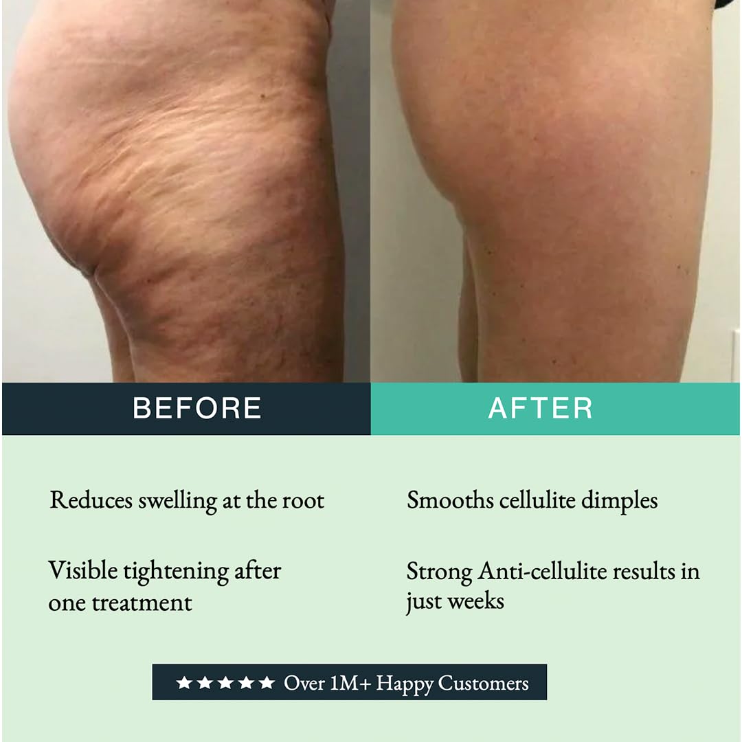 GUAM Anti-Cellulite Seaweed Mud Infrared Body Wrap – FAST-ACTION Skin Tightening & Firming Treatment with Tourmaline FIR