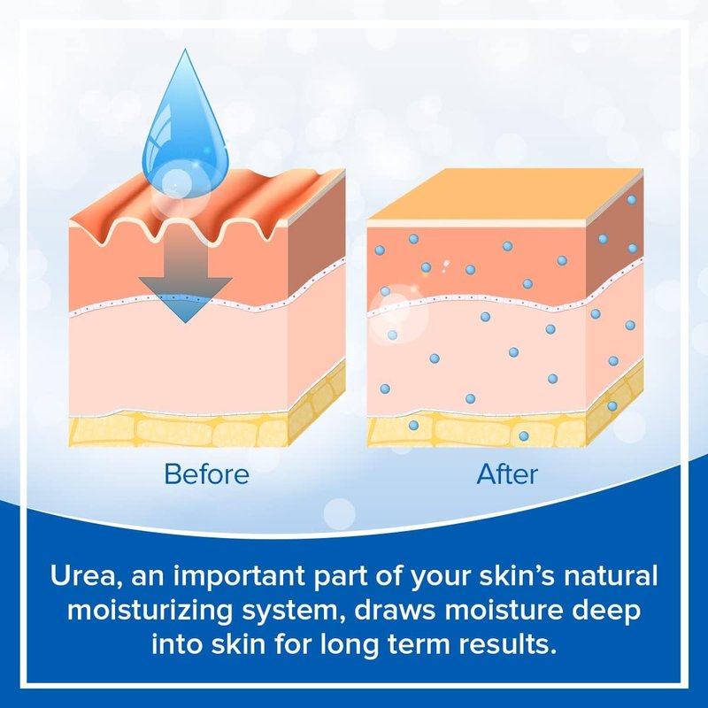 Urea 5% Cream with AHA & Green Tea Extract - Hydrating Skin Treatment for Dry Skin