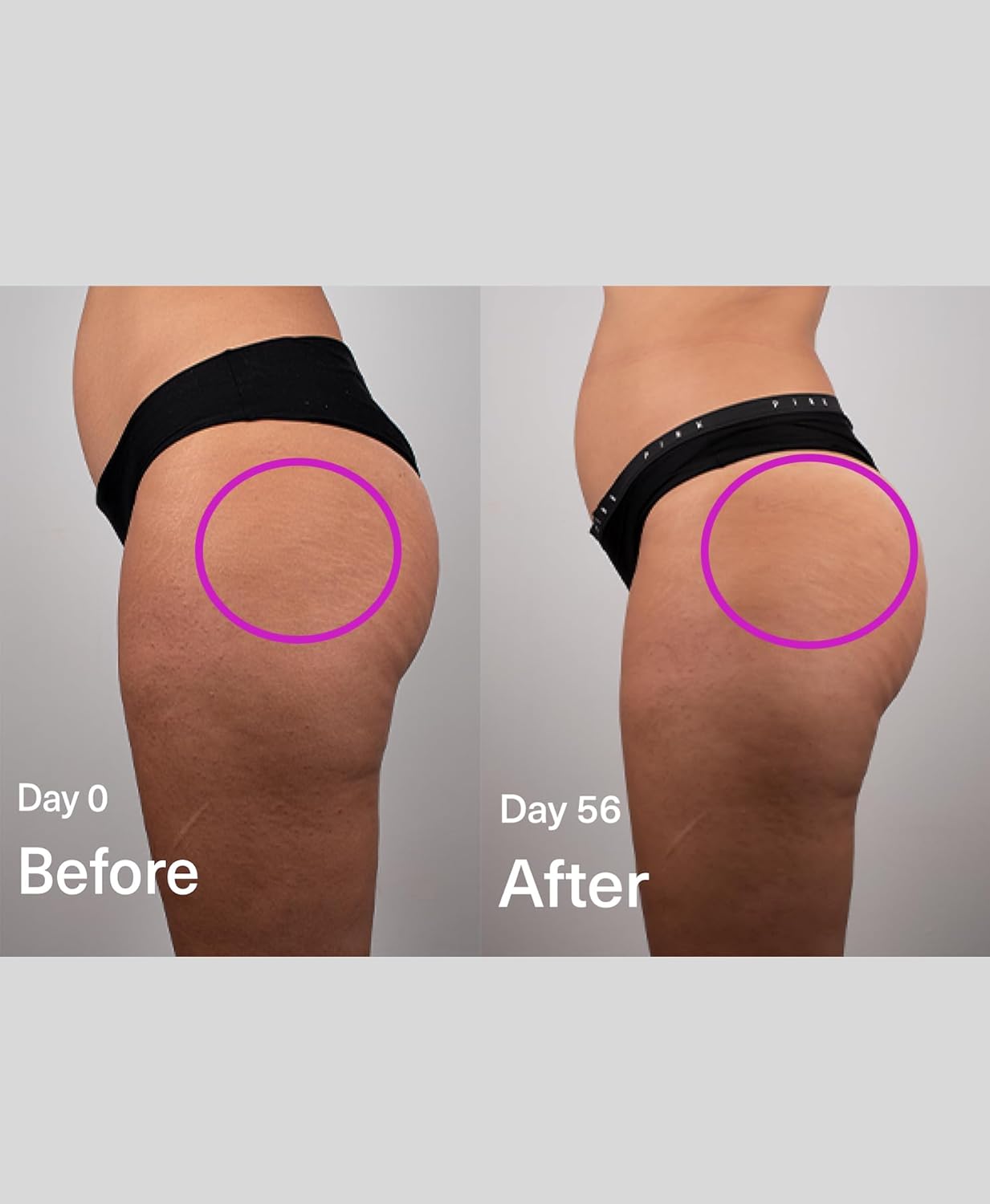 SickScience Advanced Exosome Body Firming Cream - Targets Stretch Marks & Cellulite | 100ml